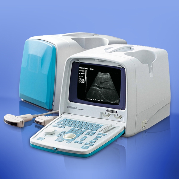ULTRASONOGRAF